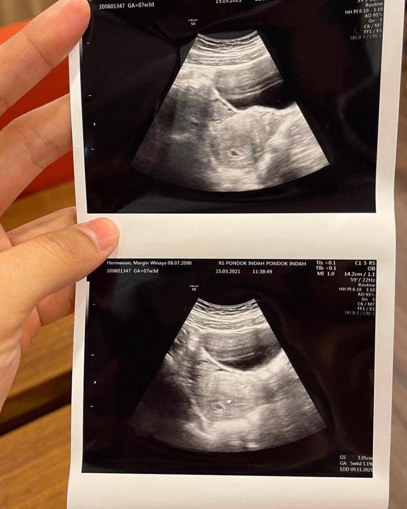 Instagram.com/alisyakieb