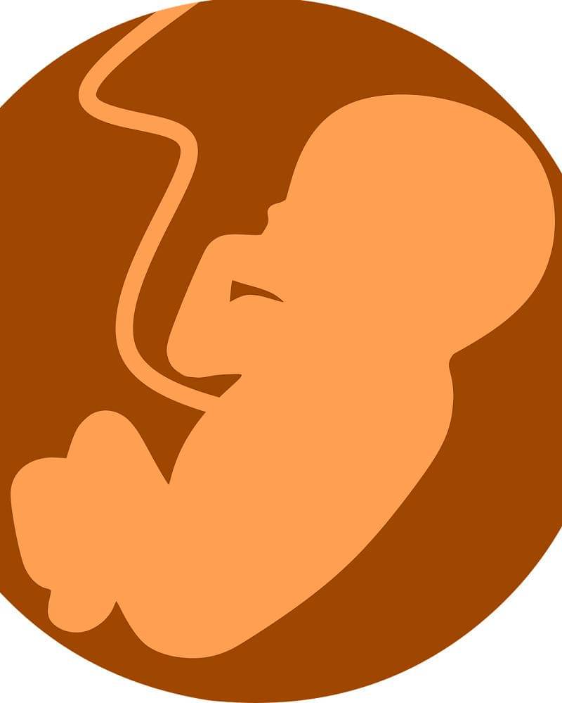 Pixabay/mohammed_hassan