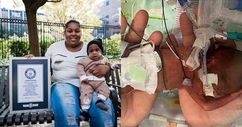 Bayi Paling Prematur di Dunia, Pecahkan Rekor Lahir di Usia 21 Minggu 