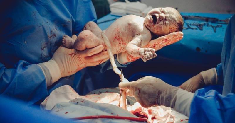 Operasi Caesar - Pexels/Vidal Balielo Jr.