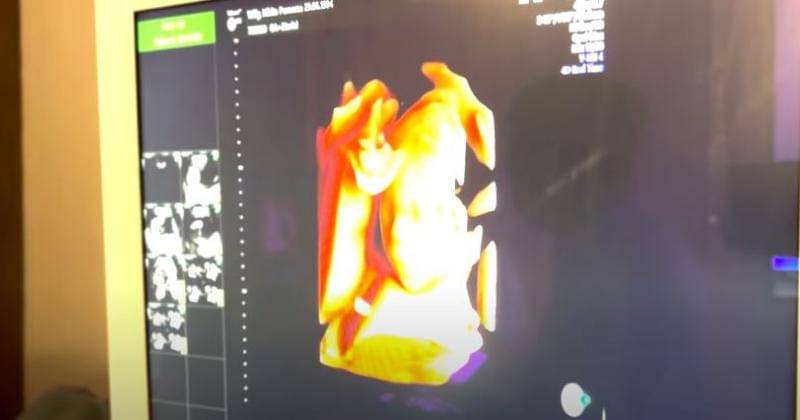 YouTube/Nikita Willy Official