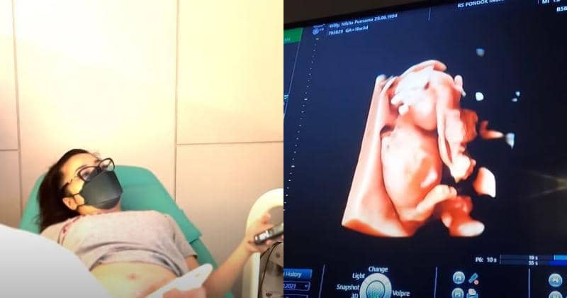 YouTube/Nikita Willy Official