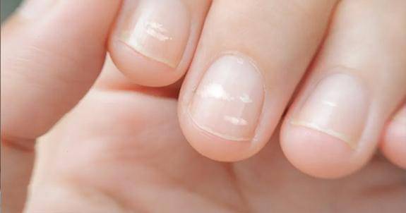 Parenting.firstcry.com