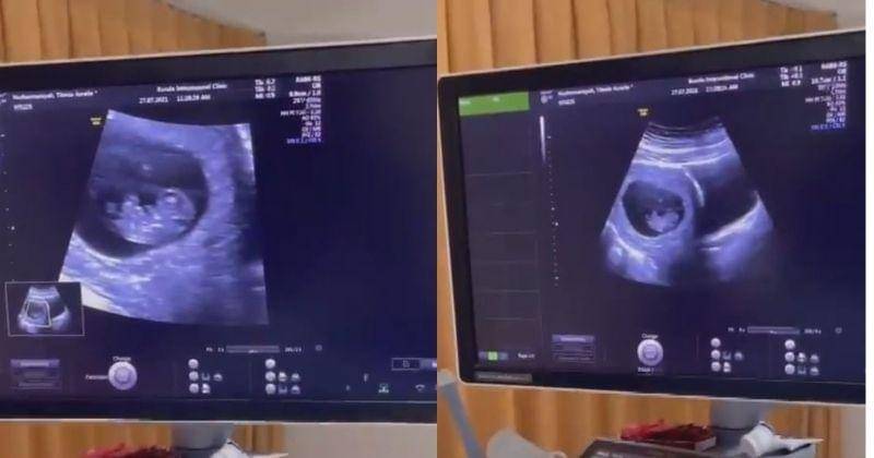 Instagram.com/aurelie.hermansyah