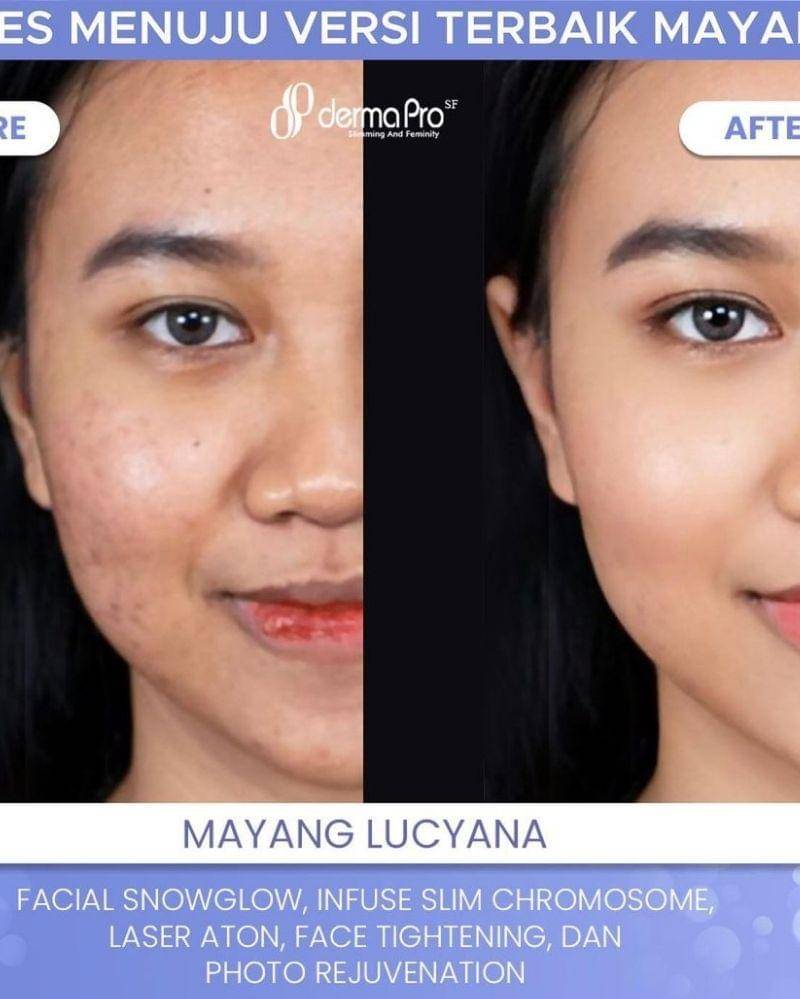 Instagram.com/dermaprosf