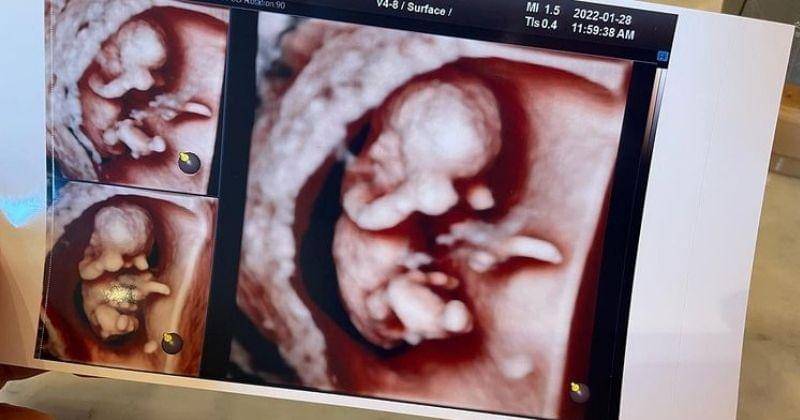 Instagram.com/@im_jasson