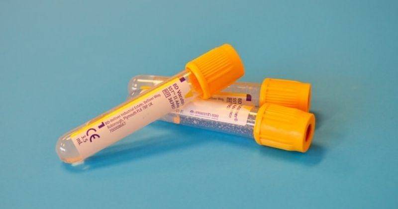 Unsplash/Testalizeme