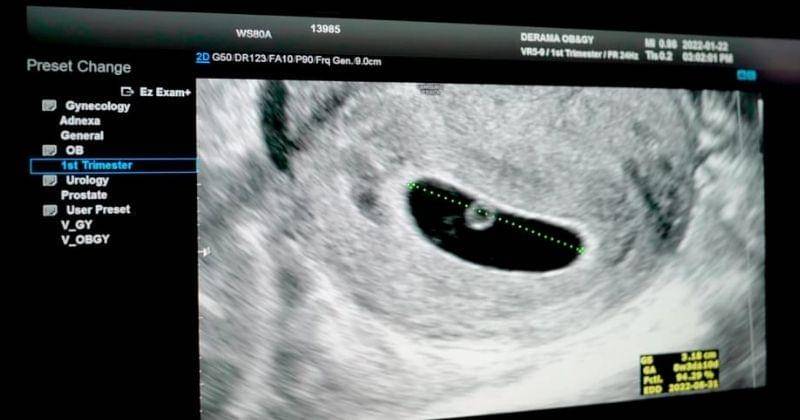 Youtube.com/JAM2 HOUSE