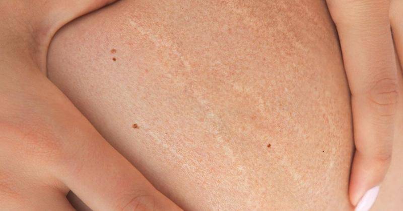 Pinterest.com/Healthline