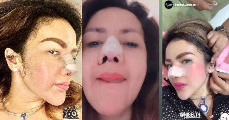 Instagram.com/barbiekumalasari