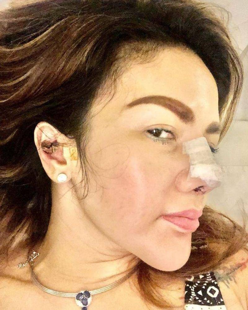 Instagram.com/barbiekumalasari