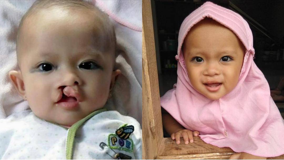 Instagram.com/smiletrainindonesia