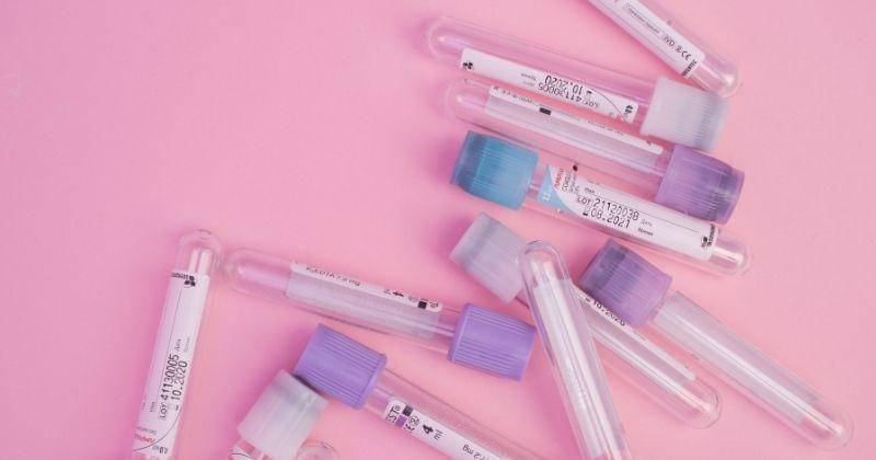 Pexels/Alena-shekhovtcova