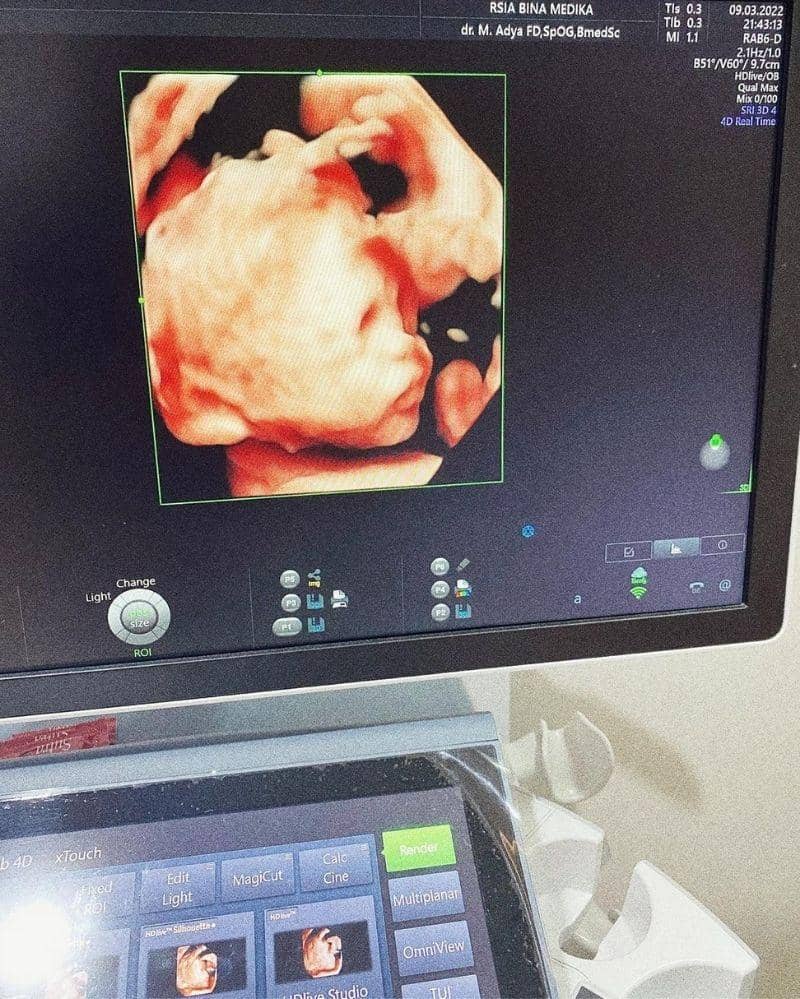 Instagram.com/bungajelitha66