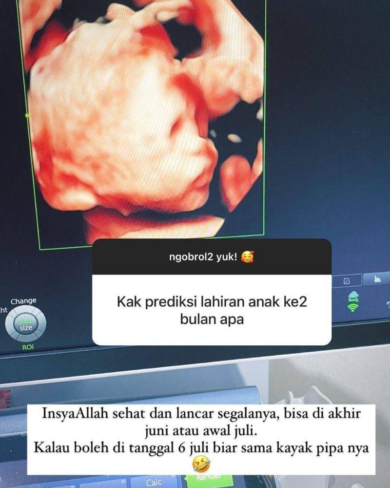 Instagram.com/bungajelitha66