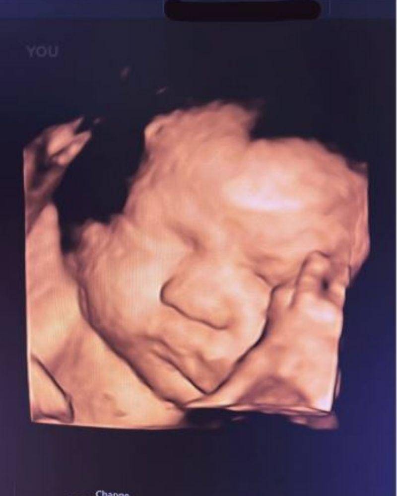 Instagram.com/aurelie.hermansyah