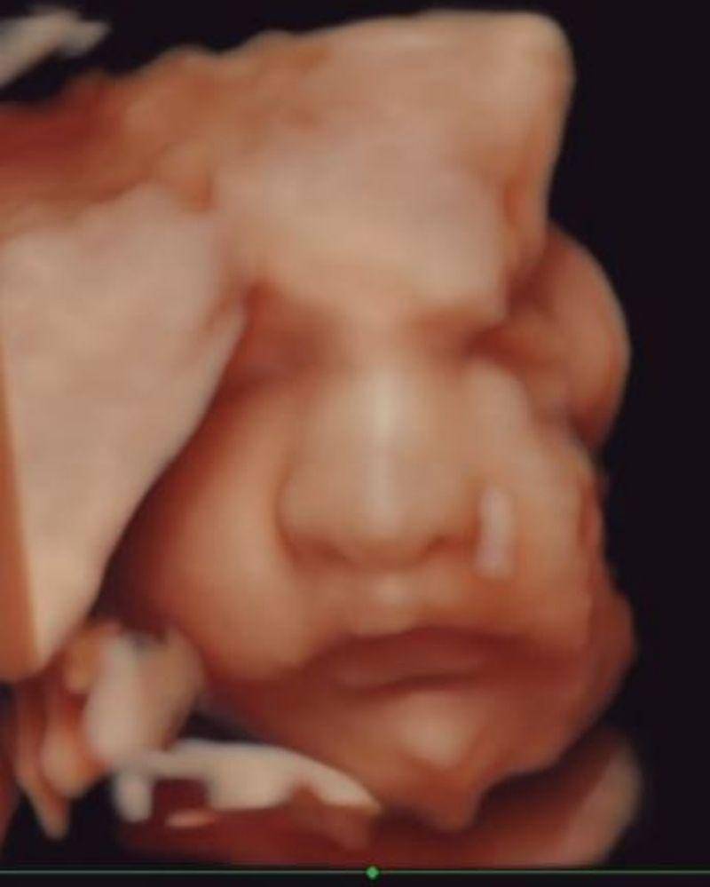 Instagram.com/nadinelist