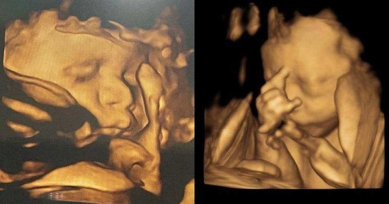 Instagram.com/rizkybillar & Instagram.com/cutratumeyriska