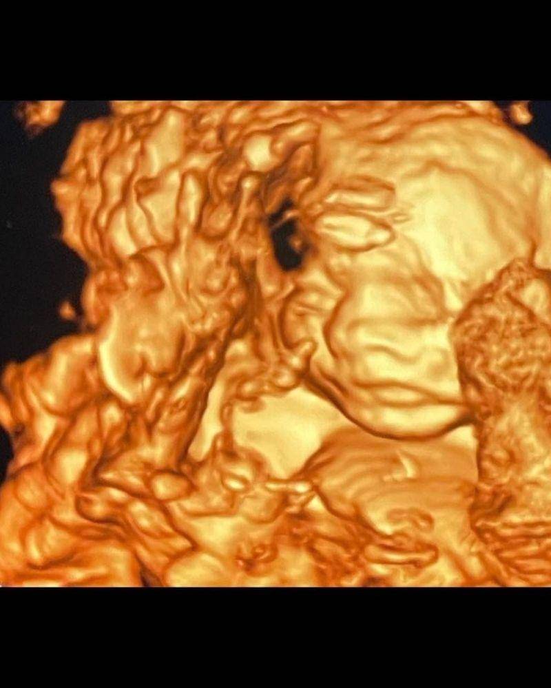 Instagram.com/frandaaa87