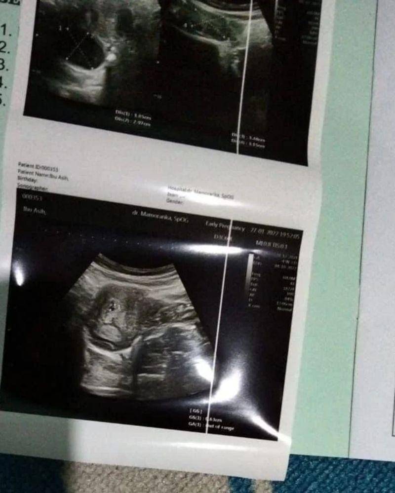 Instagram.com/zaskia_gotix