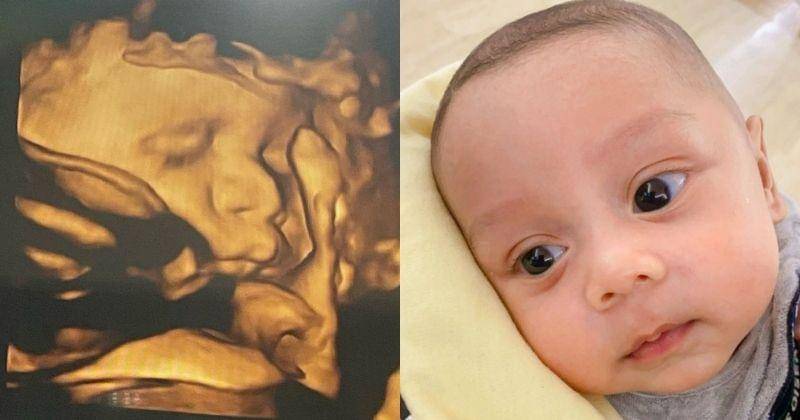 Instagram.com/rizkybillar