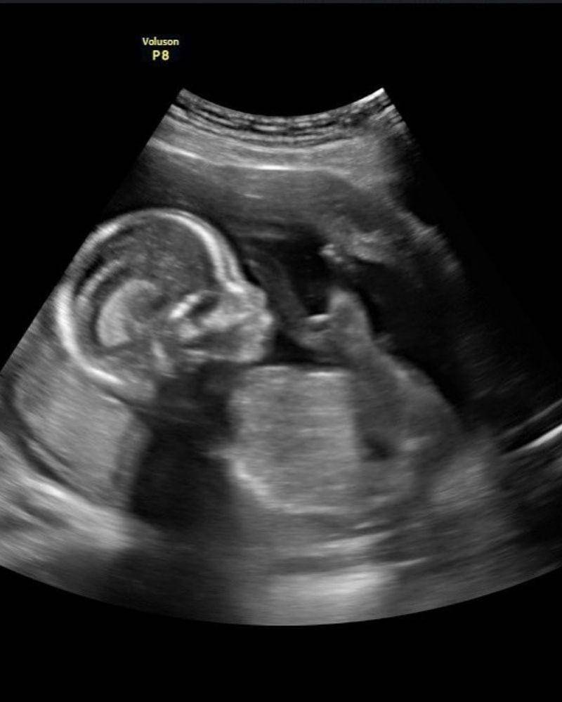 Instagram.com/inijedar