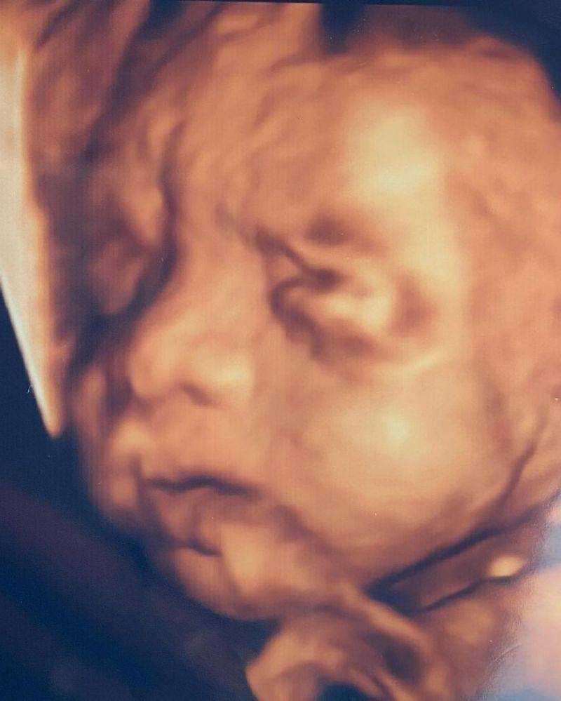 Instagram.com/adieztyfersa