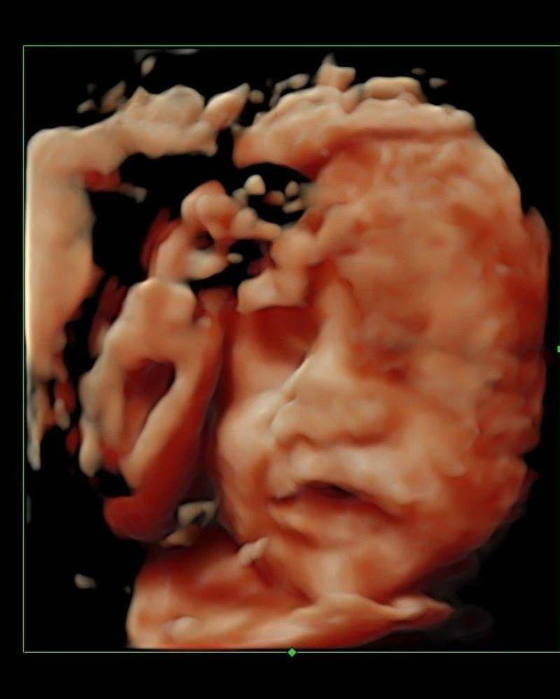 Instagram.com/faradillayoshi