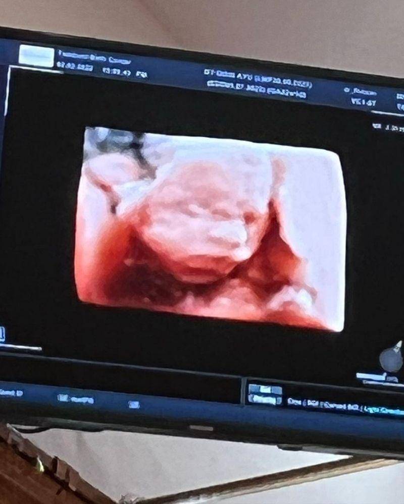 Instagram.com/dianayulestari