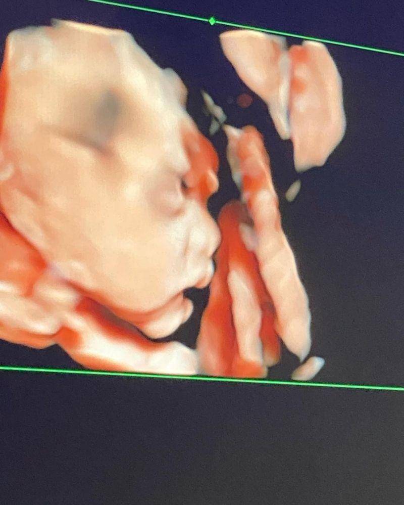 Instagram.com/ fitrop