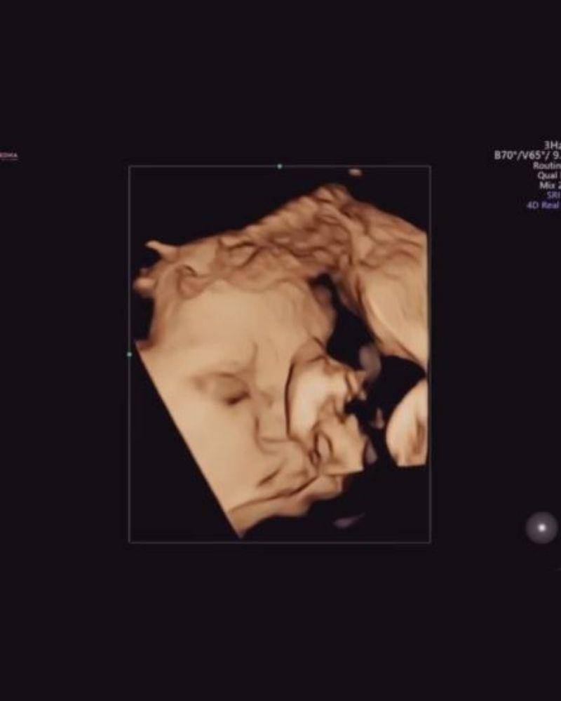 Instagram.com/sitibadriahh