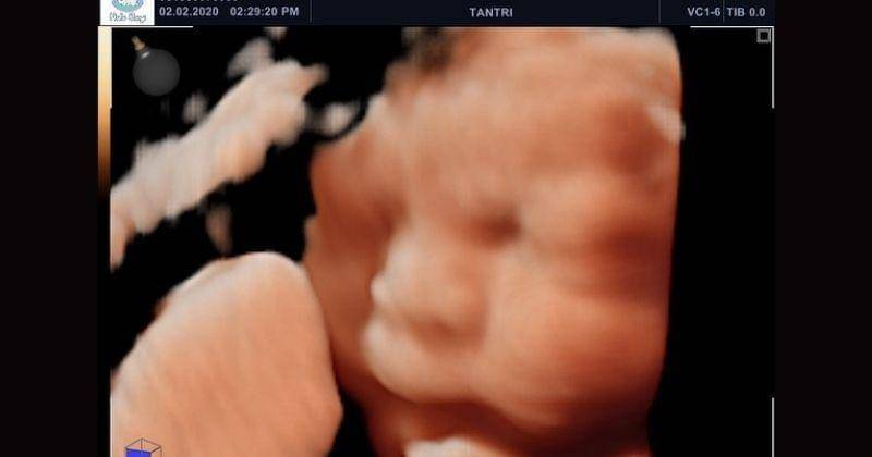 Instagram.com/tantrisyalindri