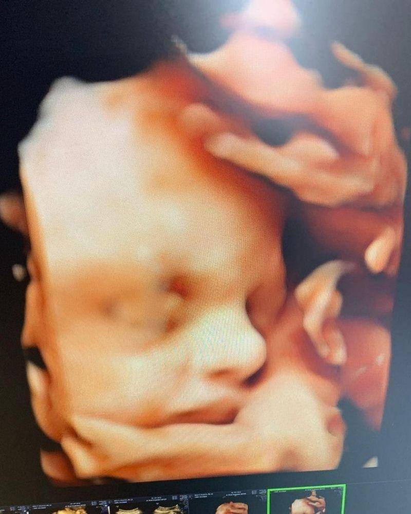 Instagram.com/ nellakharisma