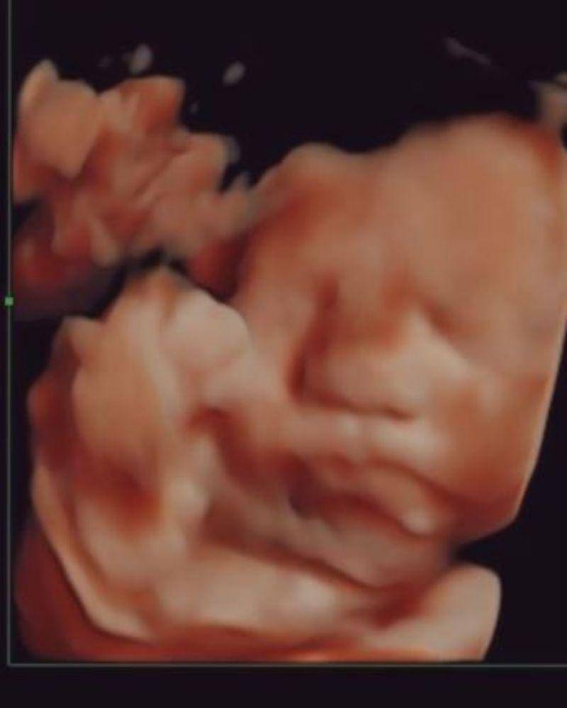 Instagram.com/felicyangelista_