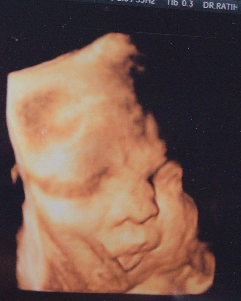 Instagram.com/tikabravani