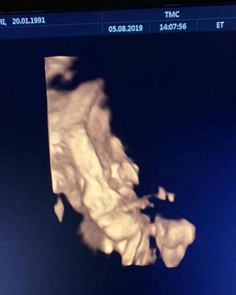 Instagram.com/kartikaputriworld