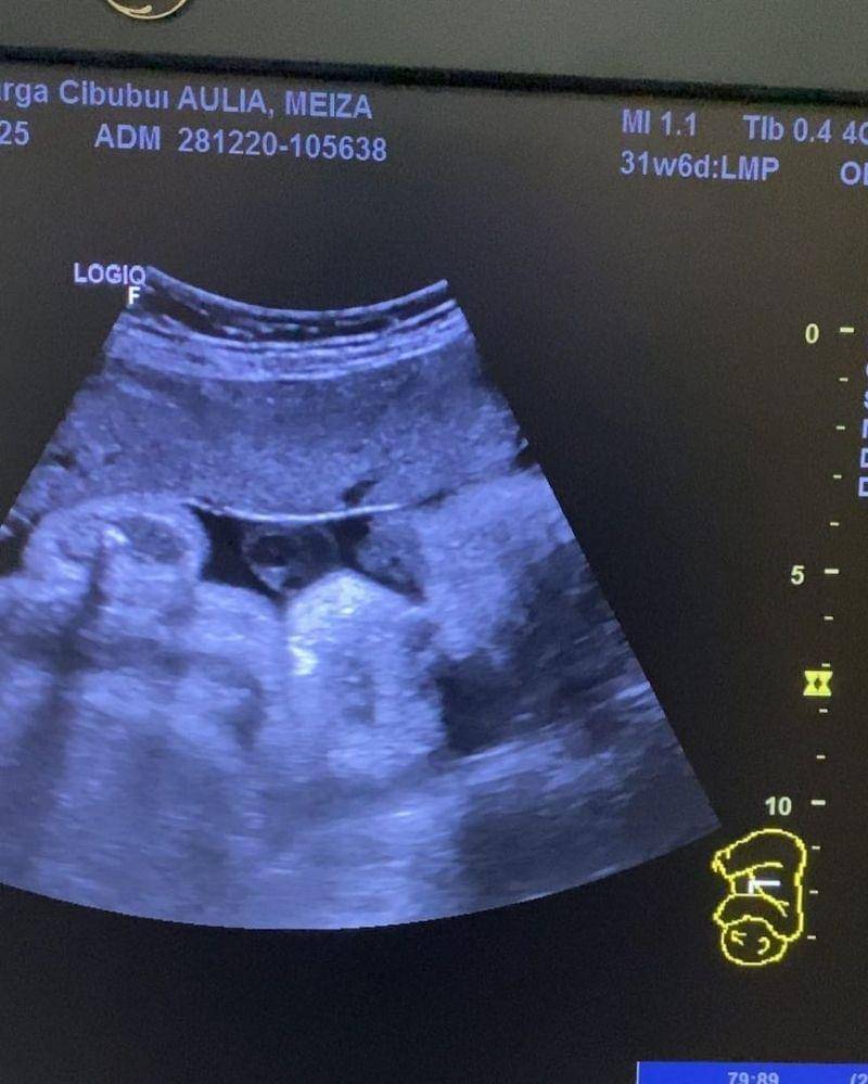 Instagram.com/ma_coritha