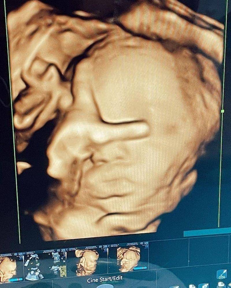 Instagram.com/jenniferbachdim