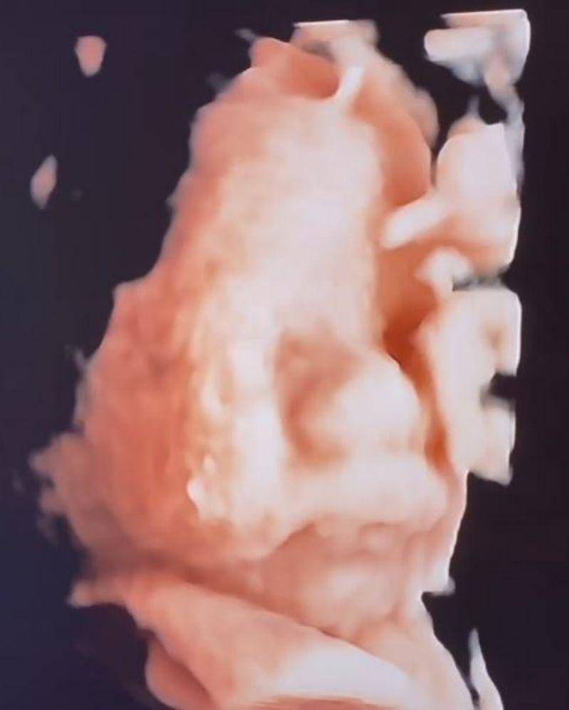 Instagram.com/achasinaga