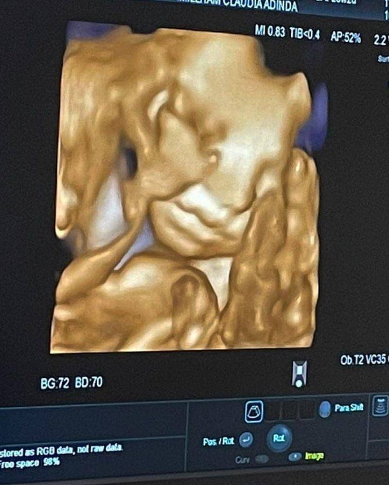 Instagram.com/derbyromero