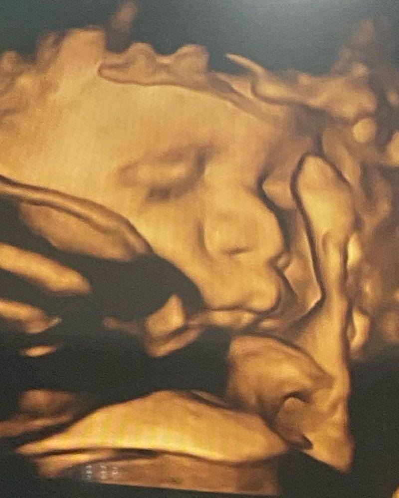 Instagram.com/rizkybillar