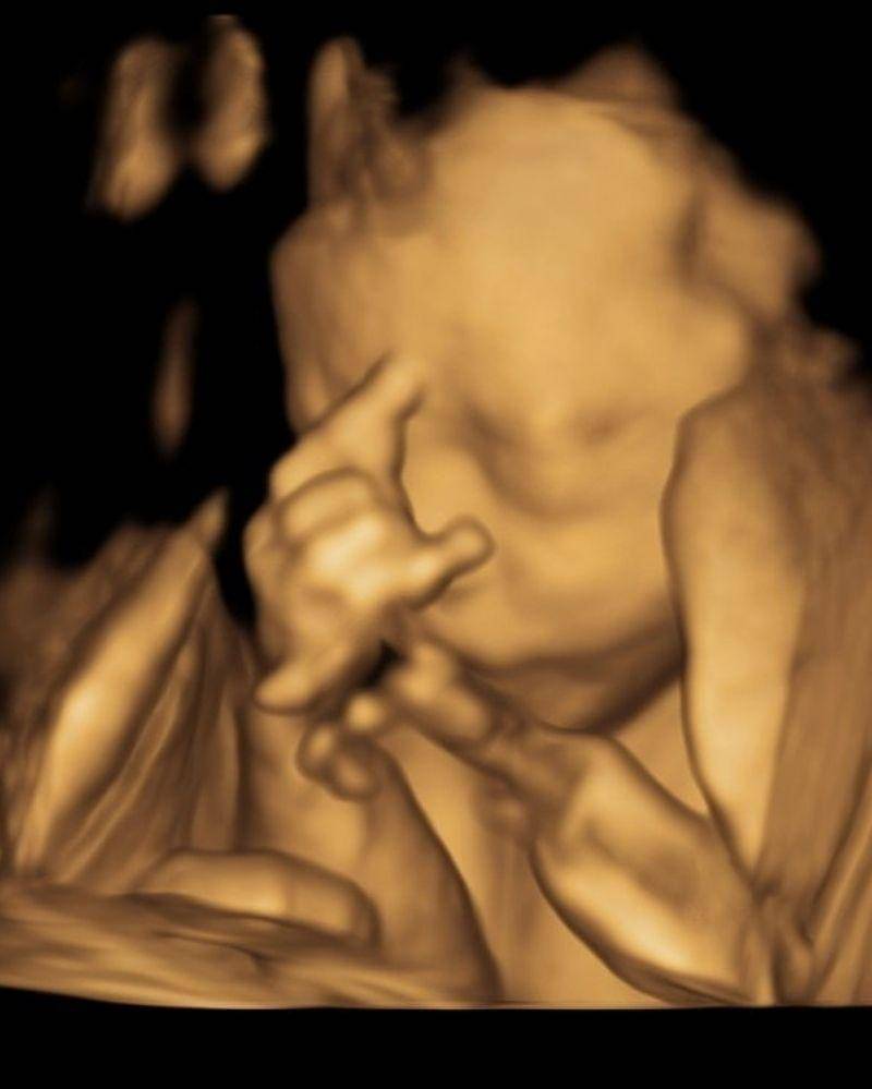 Instagram.com/cutratumeyriska