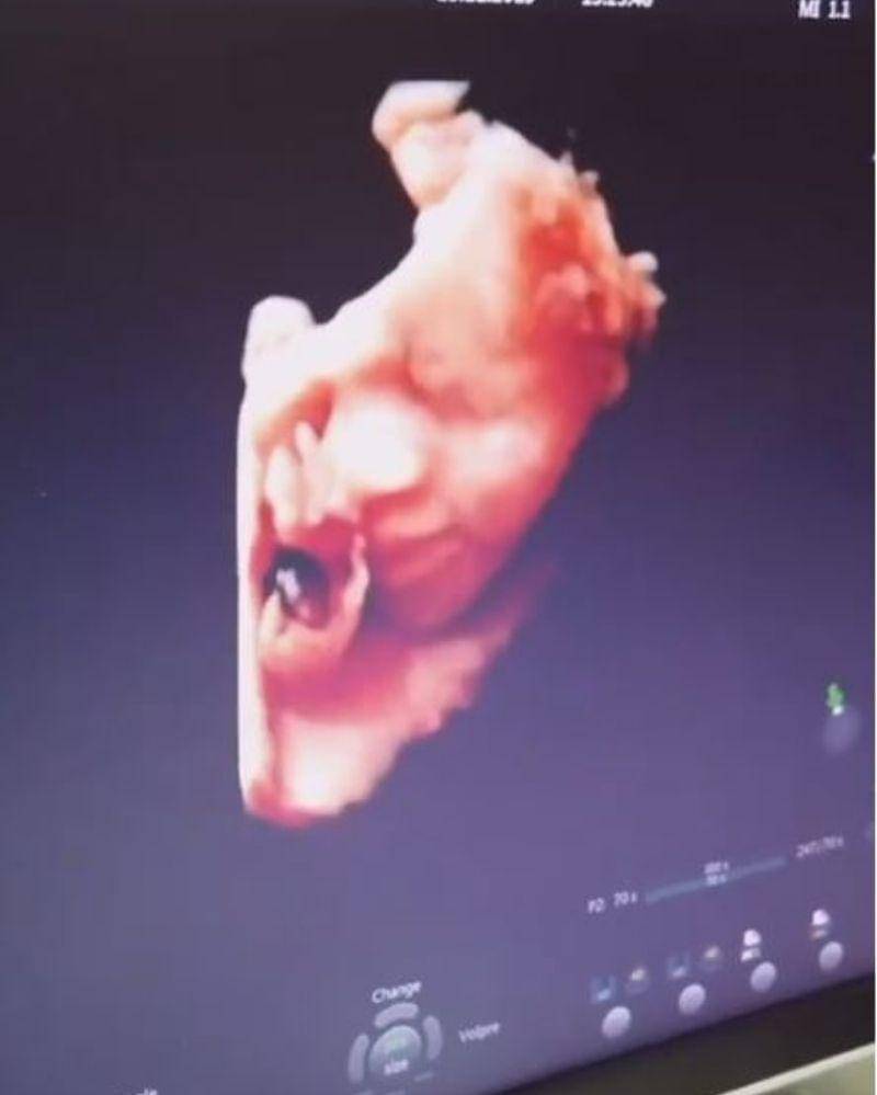 Instagram.com/syahnazs