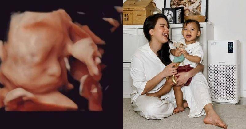 Instagram.com/alicenorin