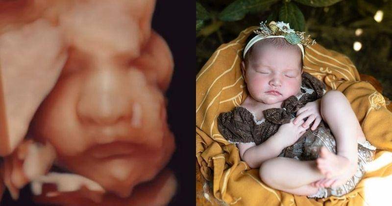 Instagram.com/nadinelist