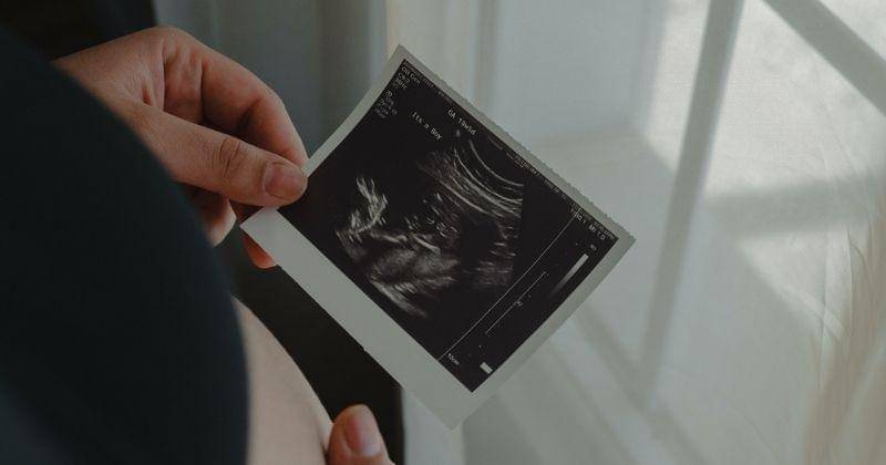 Pexels/Lazaro Rodriguez Jr