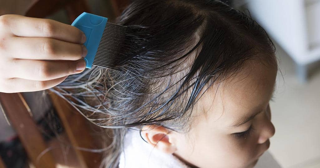 5 Tips Mencegah Kutu Rambut pada Anak Balita