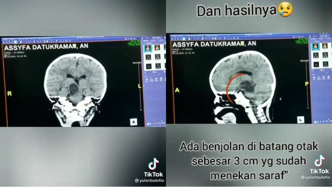 TikTok.com/yulanbulotio