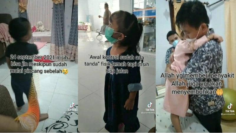 Viral Perjuangan Mengharukan Assyfa Melawan Penyakit Tumor Batang Otak