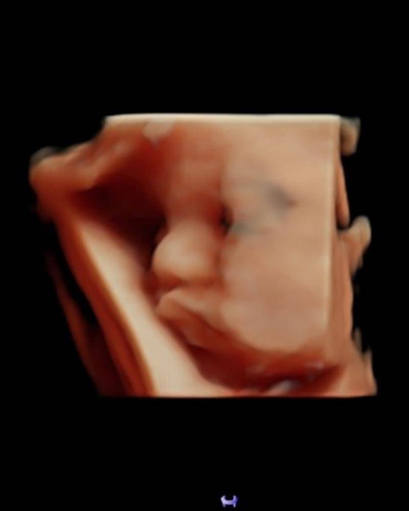 Instagram.com/soniaeryka